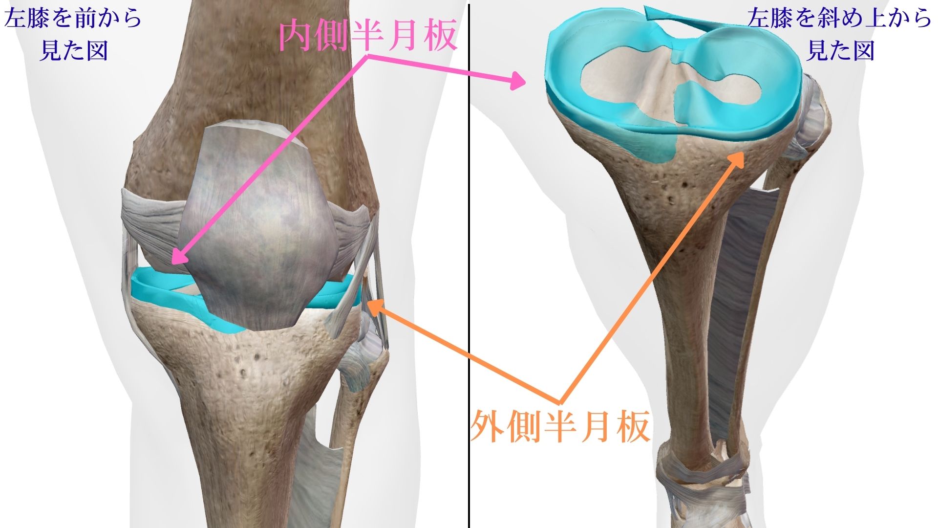 Med Lat Meniscus
